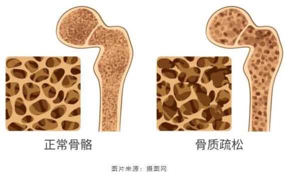 營養科普|老生常談論“補鈣”